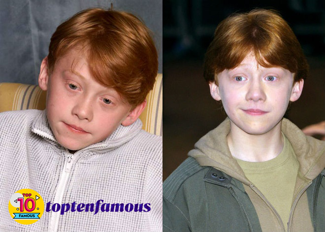 Rupert Grint in Harry Potter Then and Now
