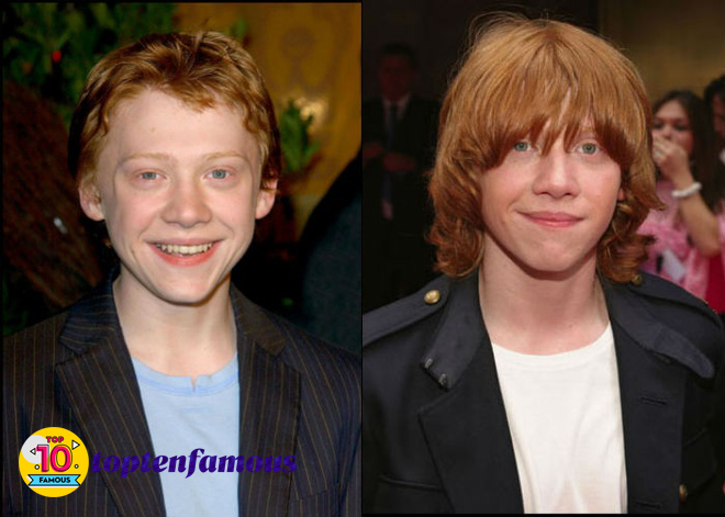 Rupert Grint in Harry Potter Then and Now