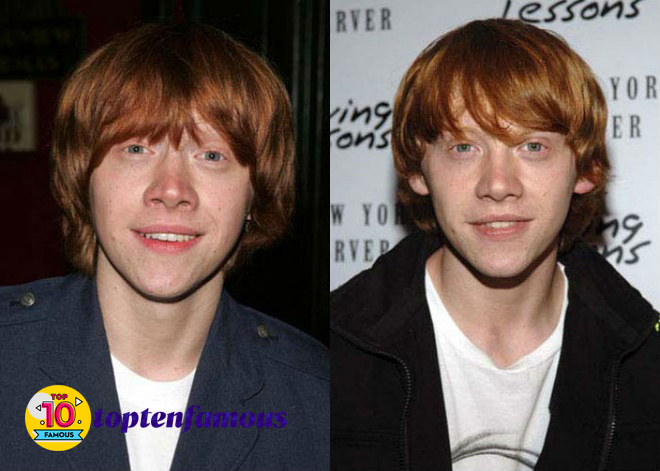 Rupert Grint in Harry Potter Then and Now